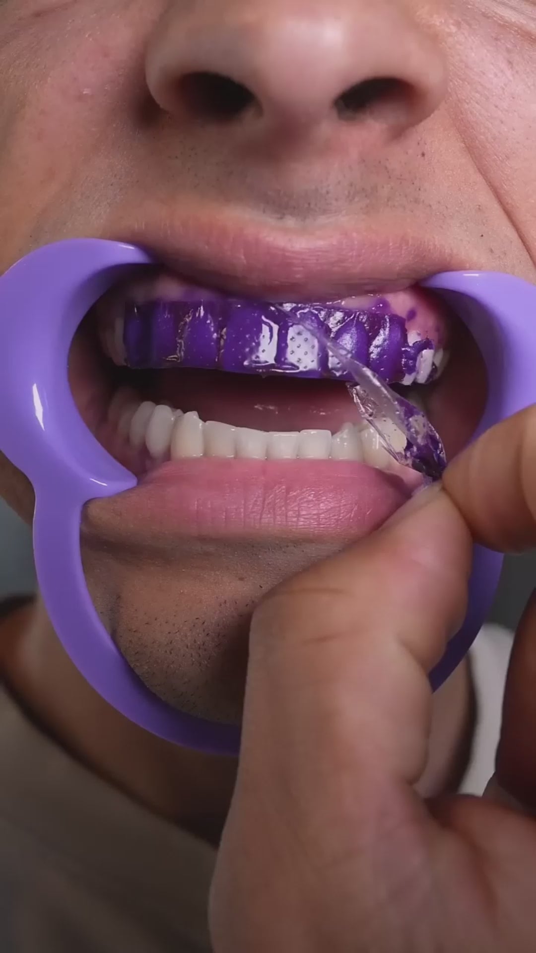 VeoDent-Teeth Whitening Strips